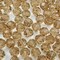 400pcs 3mm Round Crystal Glass Beads for Jewelry Making, Faceted Crystal Glass Spacer Beads for Bracelet Earring Necklace DIY Craft(Champagne)